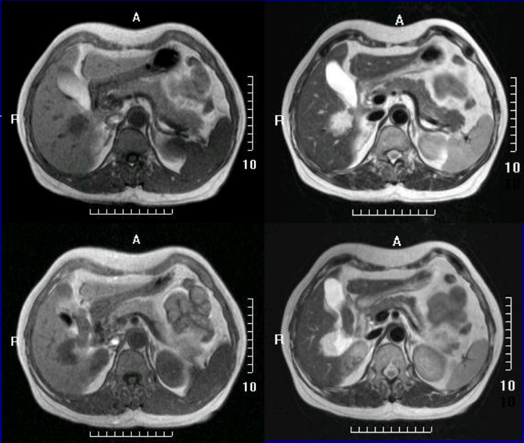 肝胆胰脾影像诊断学