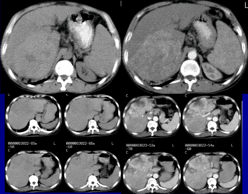 肝胆胰脾影像诊断学