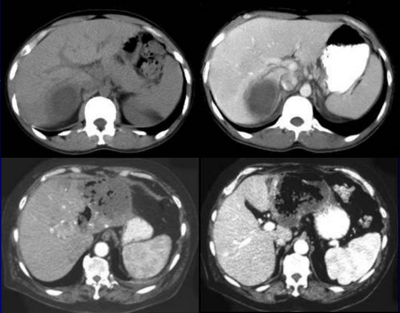 肝胆胰脾影像诊断学