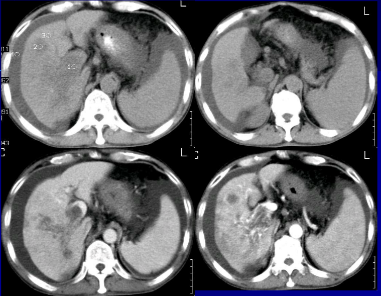 肝胆胰脾影像诊断学