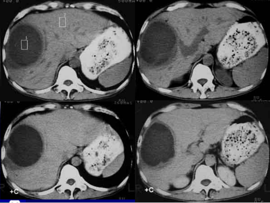 肝胆胰脾影像诊断学