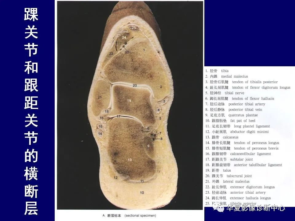 【PPT】下肢的断层解剖-70