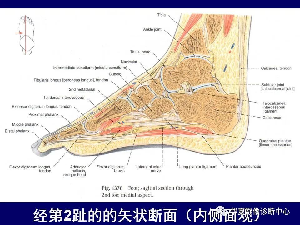 【PPT】下肢的断层解剖-73