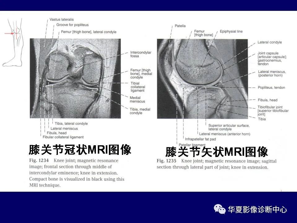 【PPT】下肢的断层解剖-57