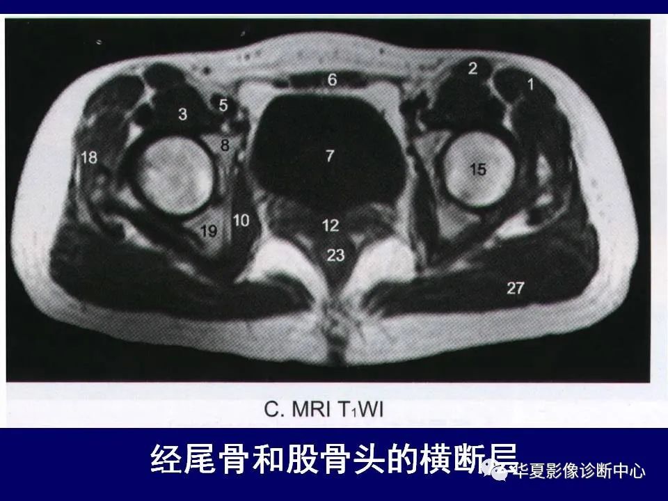 【PPT】下肢的断层解剖-19