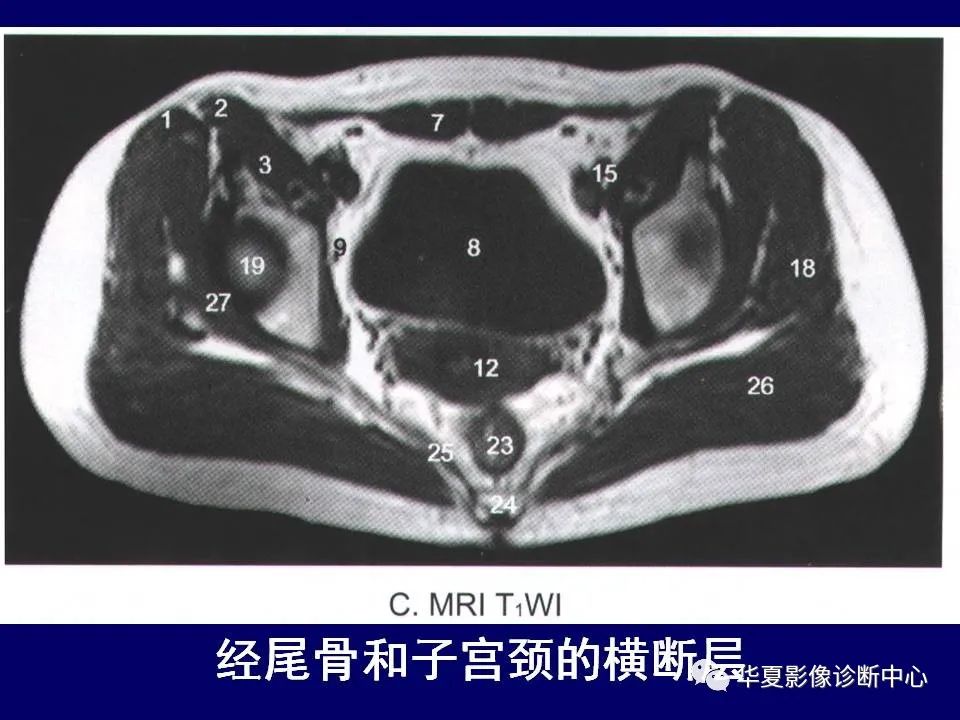 【PPT】下肢的断层解剖-15