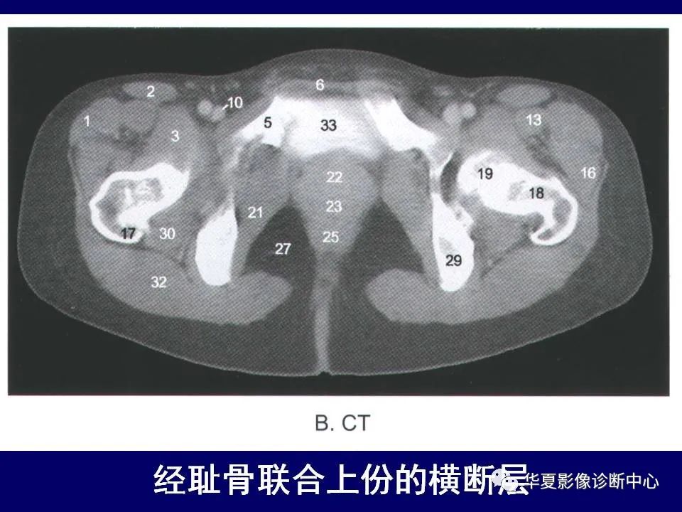 【PPT】下肢的断层解剖-26