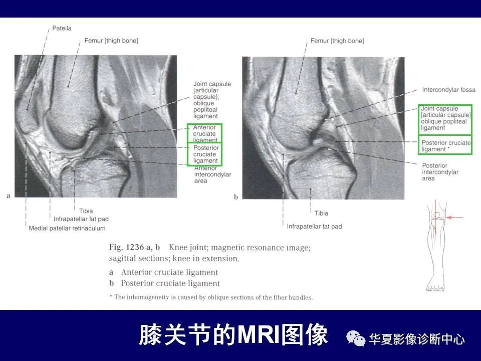 【PPT】下肢的断层解剖-58