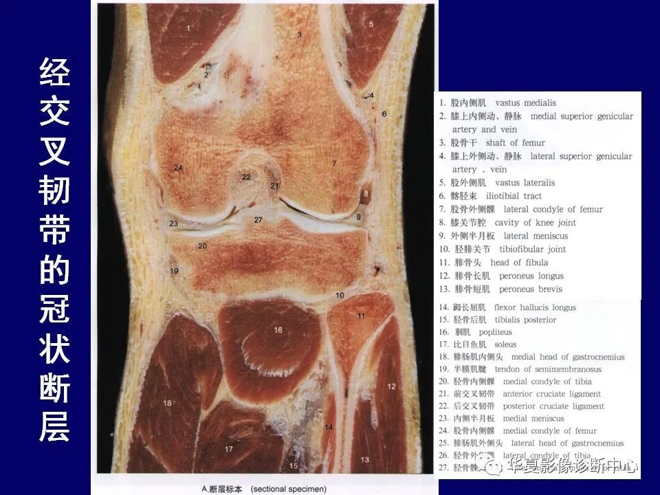 【PPT】下肢的断层解剖-54