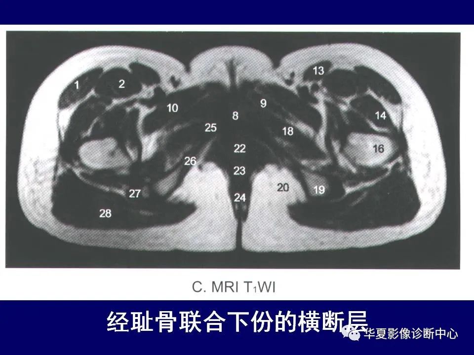 【PPT】下肢的断层解剖-35