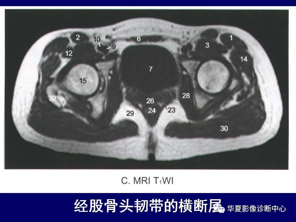 【PPT】下肢的断层解剖-23