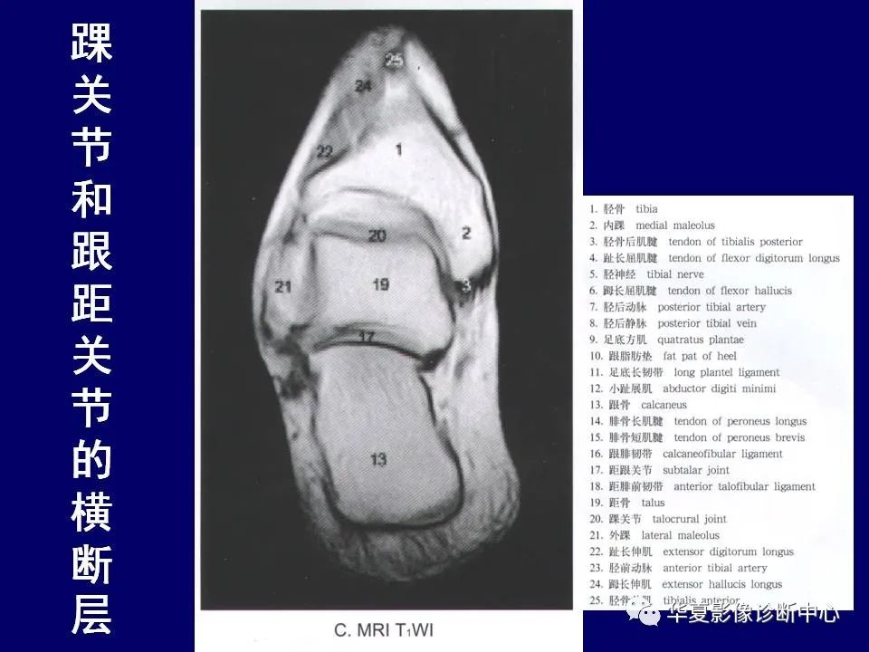 【PPT】下肢的断层解剖-72