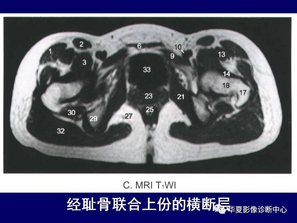 【PPT】下肢的断层解剖-27