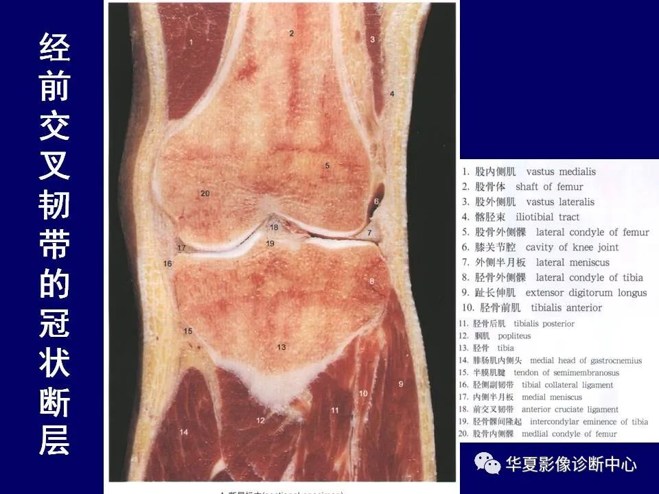 【PPT】下肢的断层解剖-52