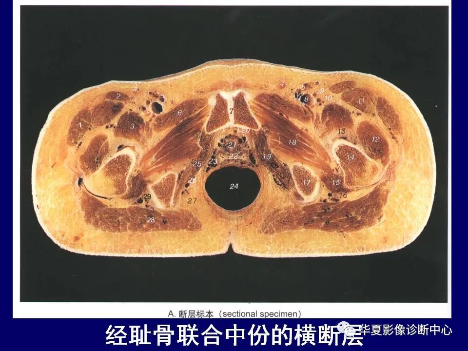 【PPT】下肢的断层解剖-29