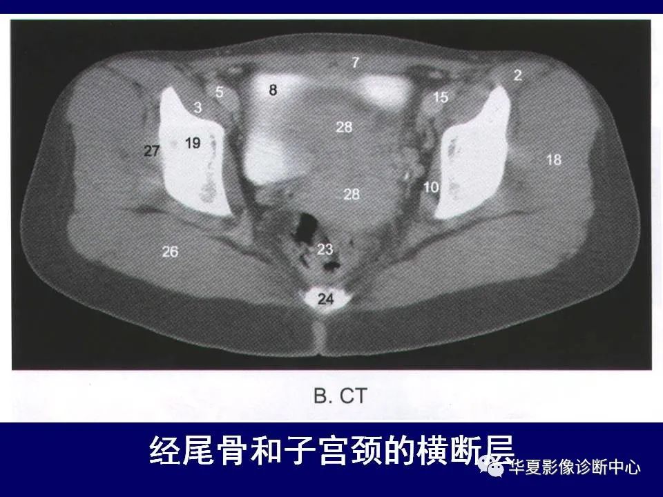 【PPT】下肢的断层解剖-14