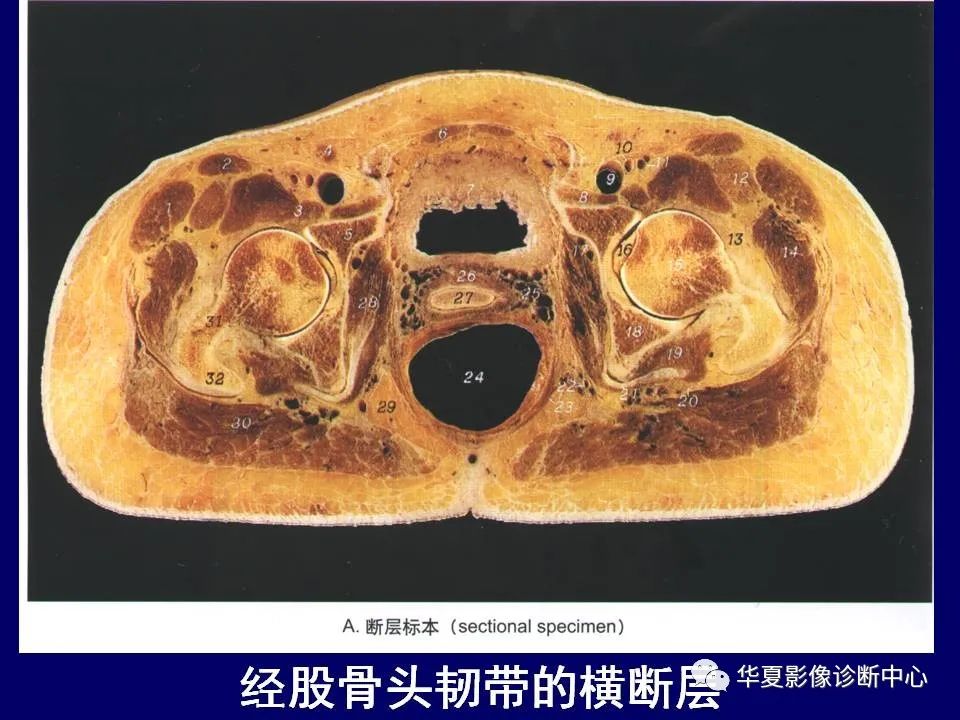 【PPT】下肢的断层解剖-21
