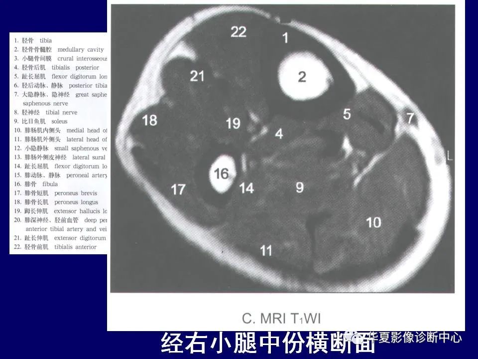 【PPT】下肢的断层解剖-64
