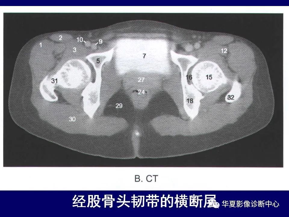 【PPT】下肢的断层解剖-22