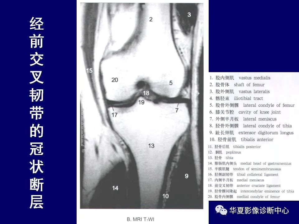 【PPT】下肢的断层解剖-53