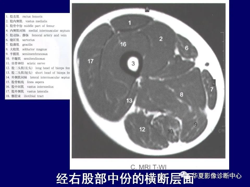 【PPT】下肢的断层解剖-39