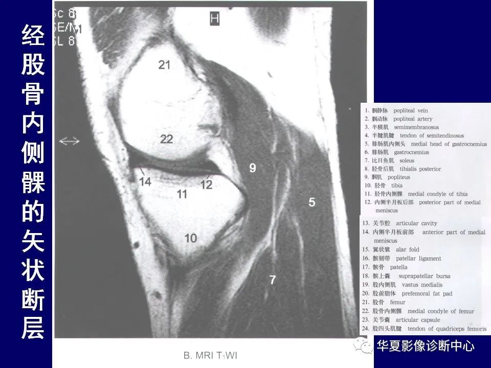 【PPT】下肢的断层解剖-48