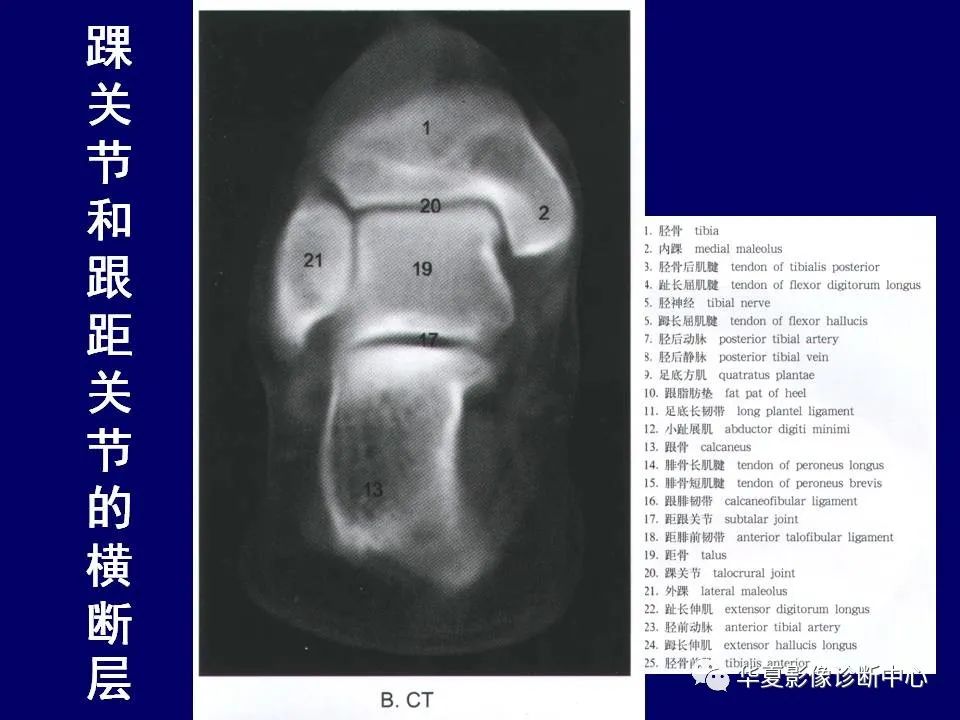【PPT】下肢的断层解剖-71