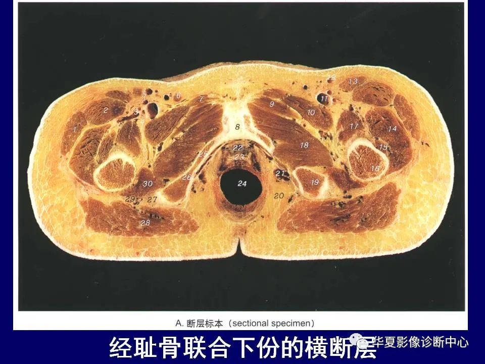 【PPT】下肢的断层解剖-33