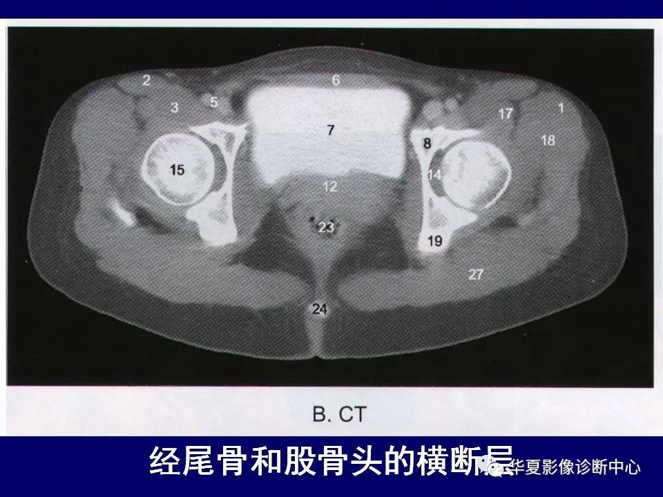 【PPT】下肢的断层解剖-18