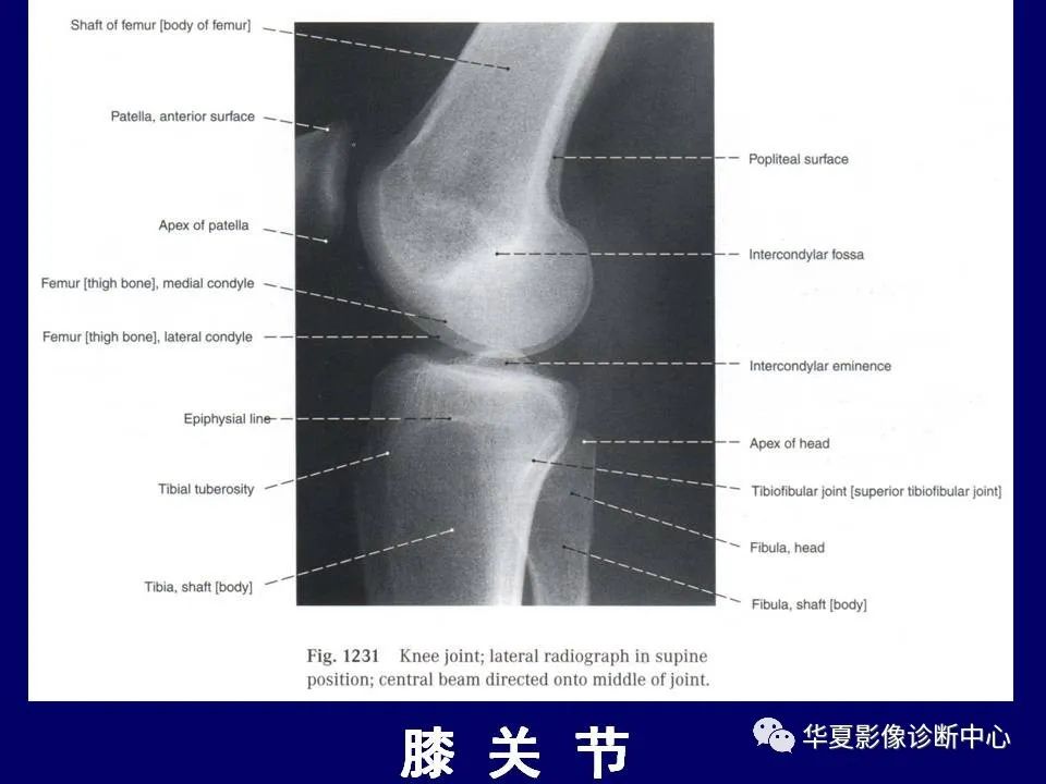 【PPT】下肢的断层解剖-42