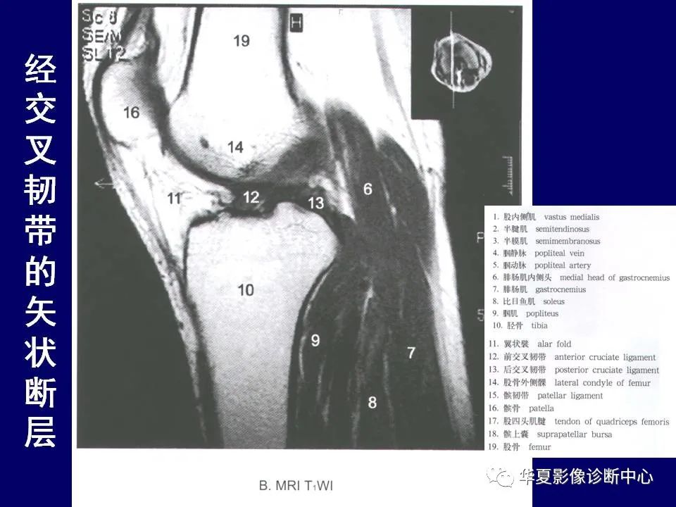 【PPT】下肢的断层解剖-51