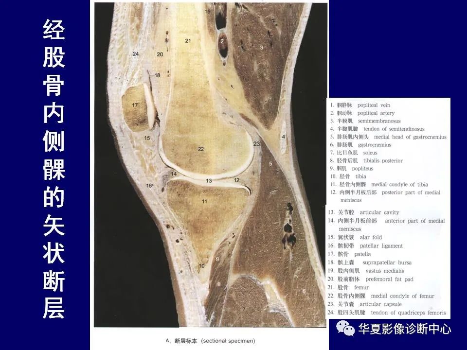 【PPT】下肢的断层解剖-47