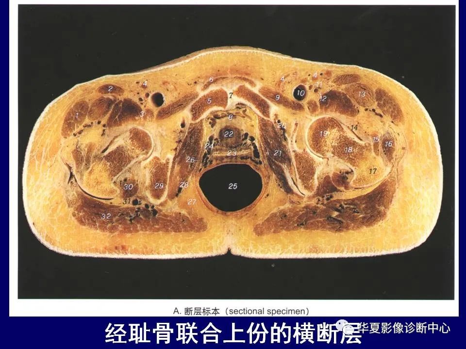 【PPT】下肢的断层解剖-25