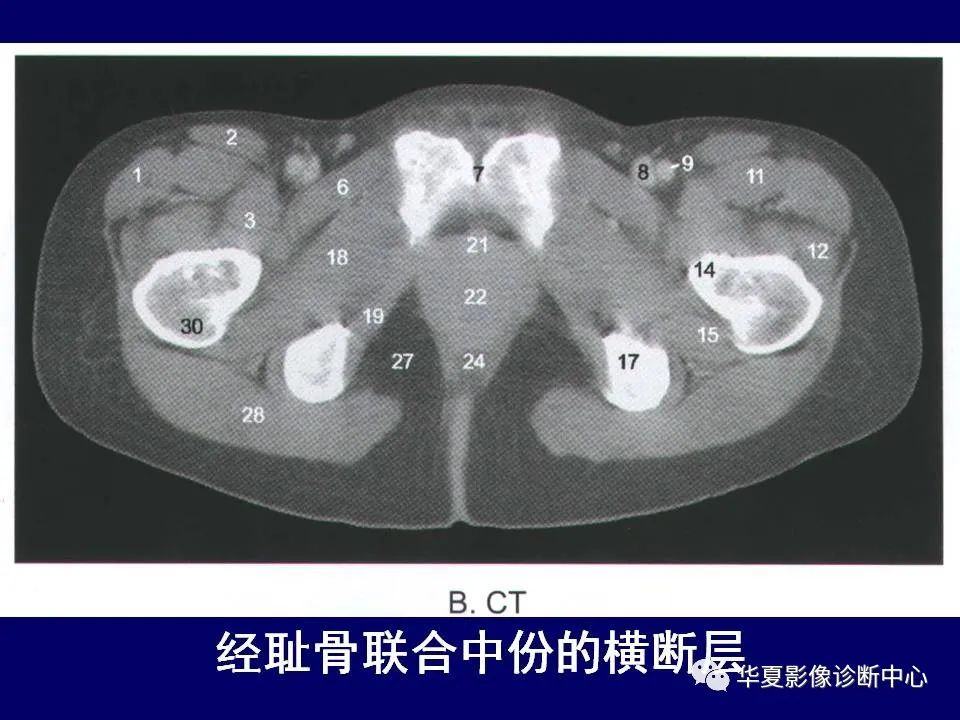 【PPT】下肢的断层解剖-30