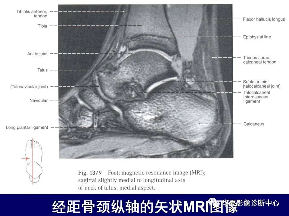 【PPT】下肢的断层解剖-74