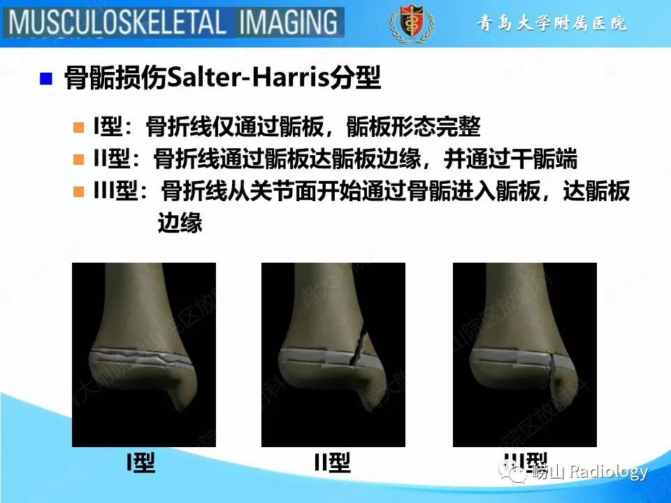 【PPT】索尔特骨折-5