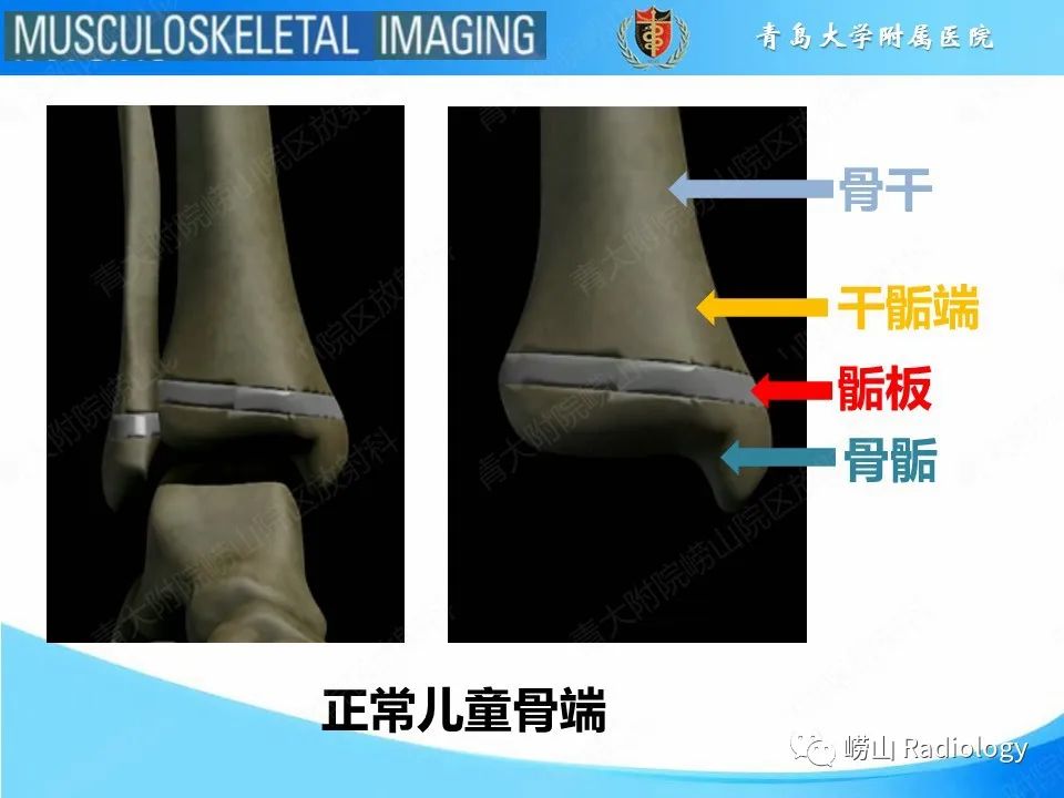 【PPT】索尔特骨折-4