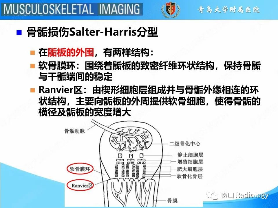 【PPT】索尔特骨折-7