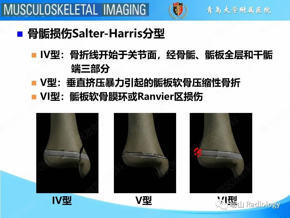 【PPT】索尔特骨折-6
