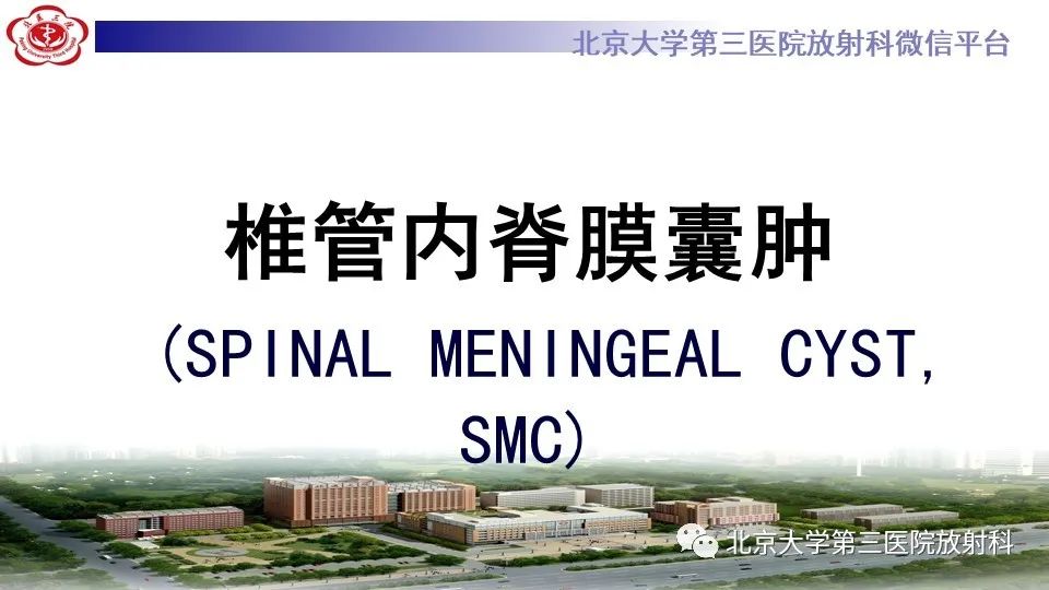 【PPT】椎管内脊膜囊肿-15