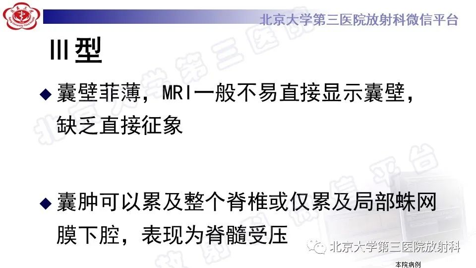 【PPT】椎管内脊膜囊肿-32