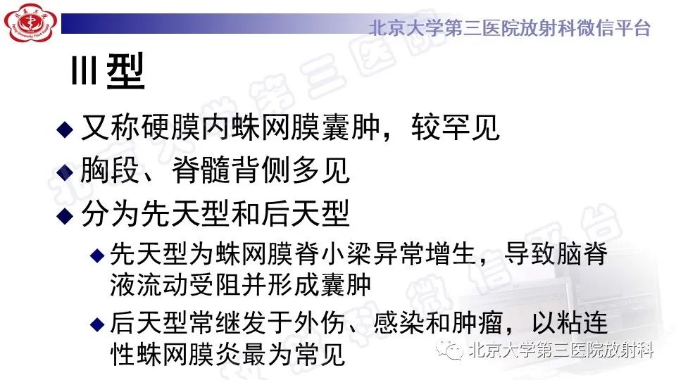 【PPT】椎管内脊膜囊肿-31