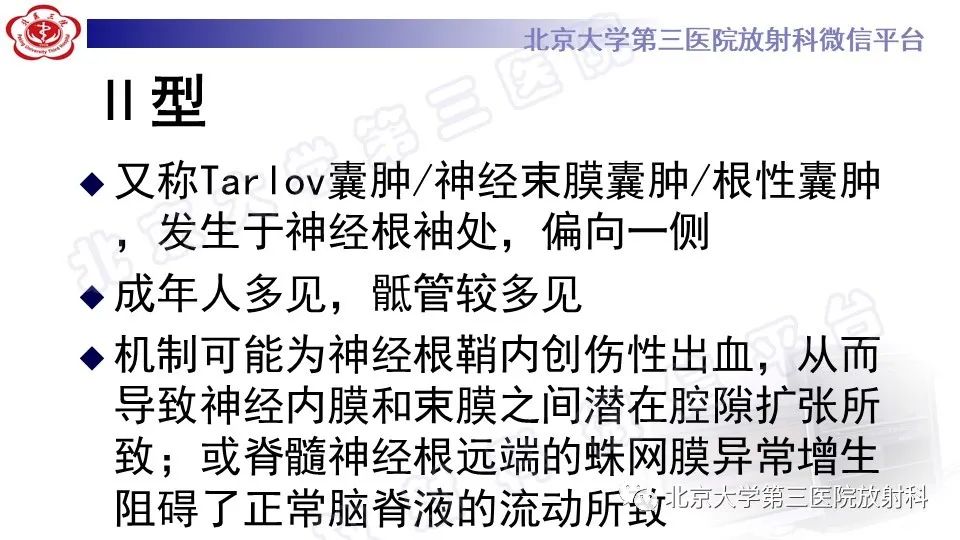 【PPT】椎管内脊膜囊肿-27