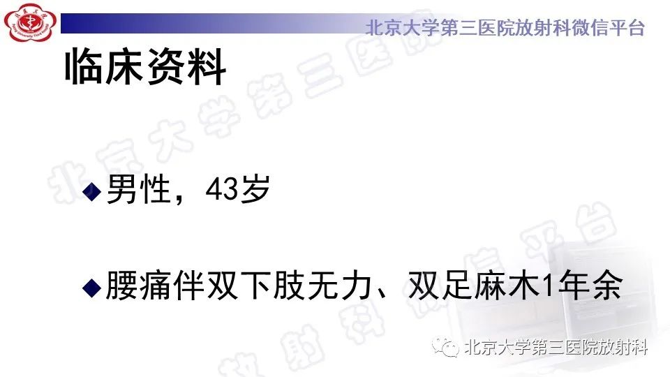 【PPT】椎管内脊膜囊肿-2