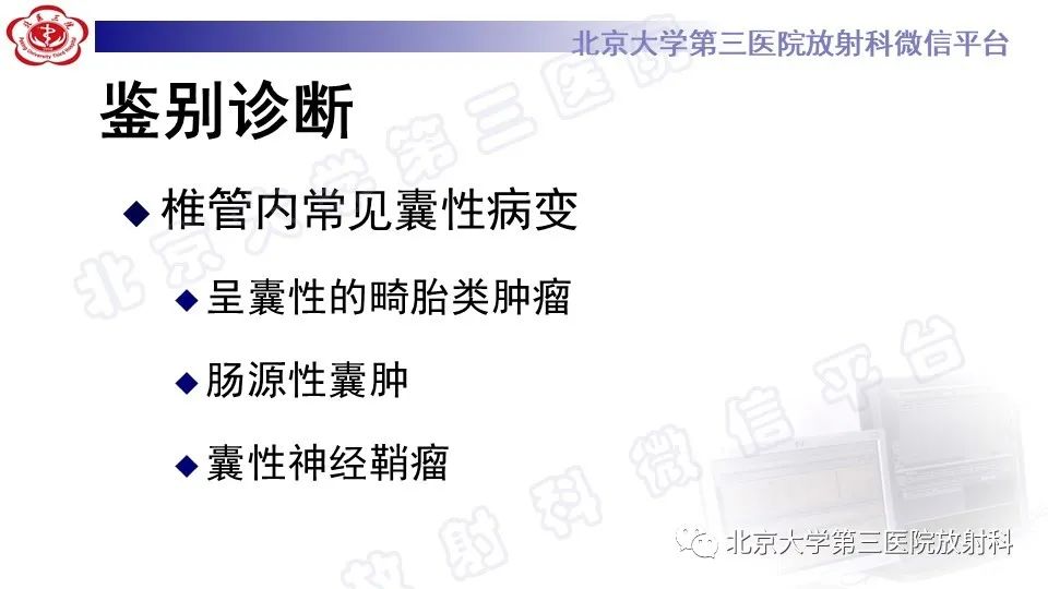 【PPT】椎管内脊膜囊肿-36