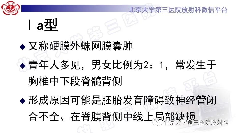 【PPT】椎管内脊膜囊肿-20