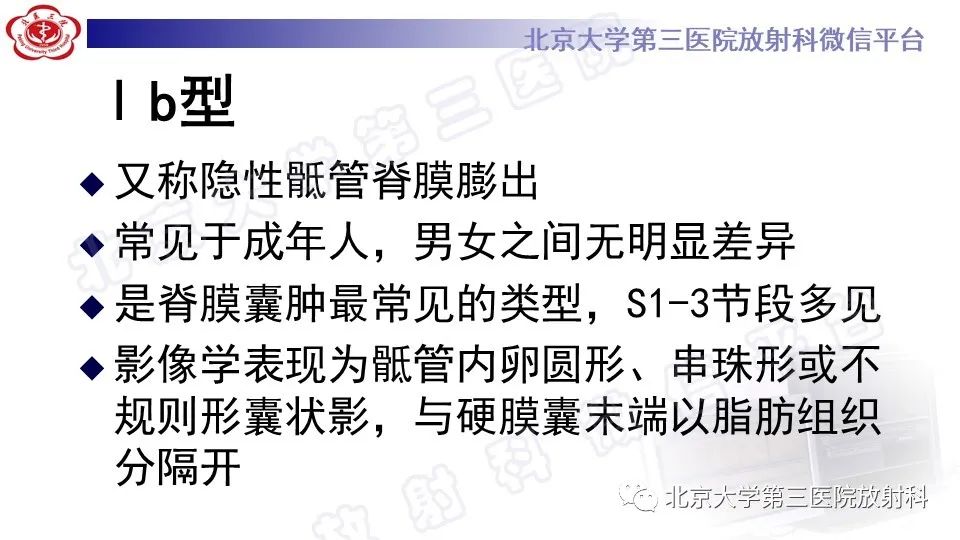 【PPT】椎管内脊膜囊肿-24