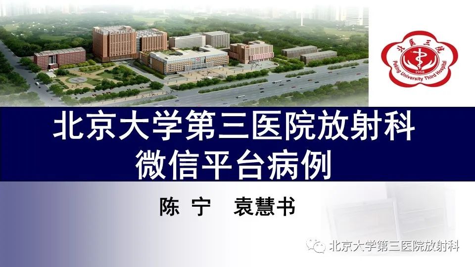 椎管内脊膜囊肿