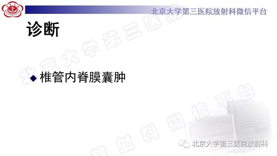 【PPT】椎管内脊膜囊肿-14