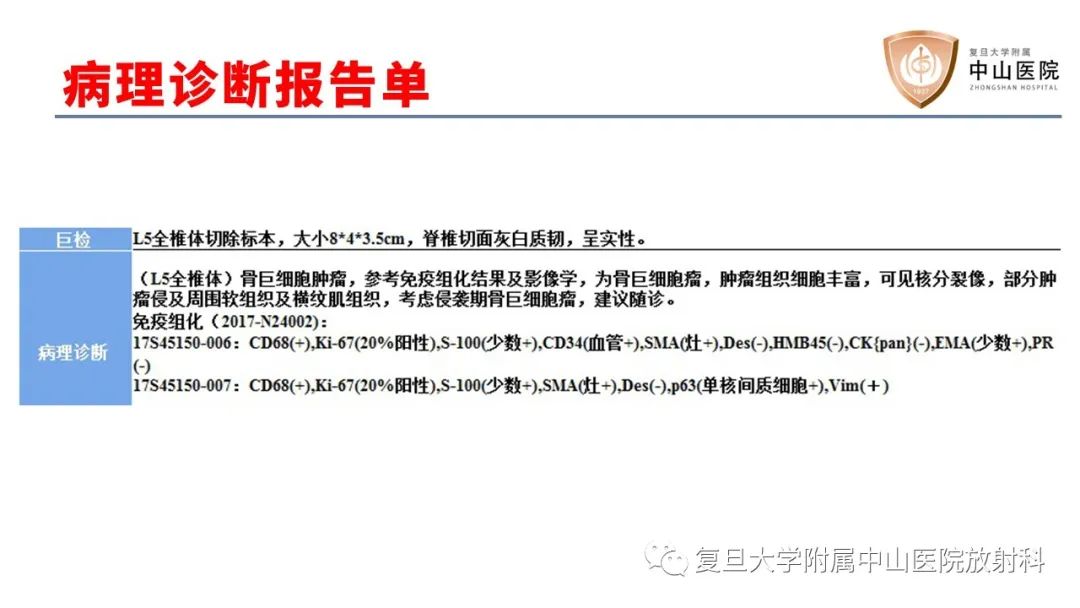 【病例】脊柱骨巨细胞瘤1例CT及MR影像-7